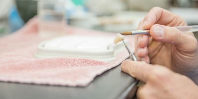 Zahnersatz und Implantate aus dem eigenen Dentallabor